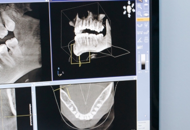 3D kompiuterinė tomografija