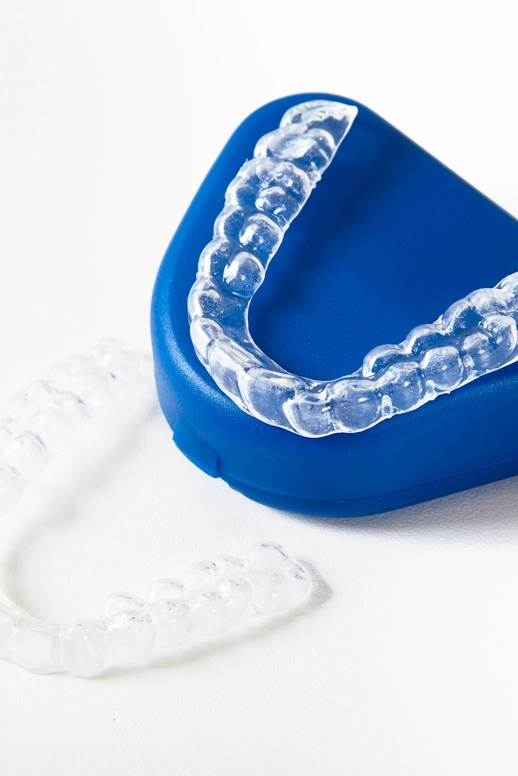 Dantų tiesinimas kapomis