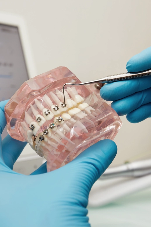 Ortodontinis gydymas